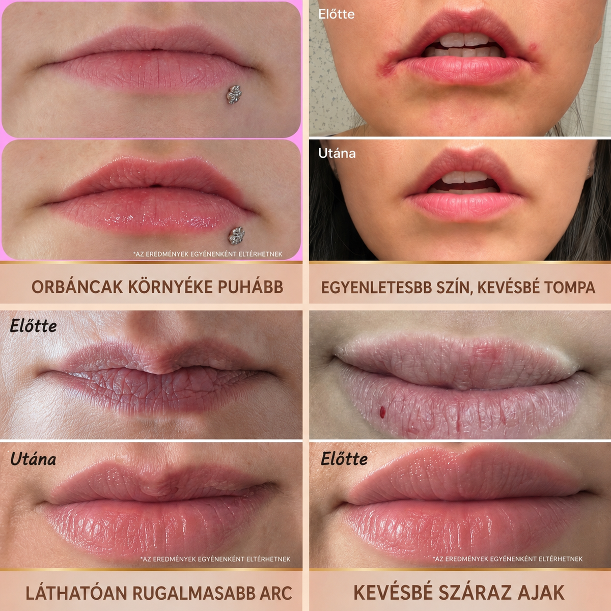 HISKIN® Golden Silk Protein Peptide Beauty Pen — Célzott szépségápolás a ráncok, szemkörnyék és ajkak ápolására | Látható eredmény már 3 nap alatt ✨