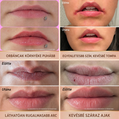 HISKIN® Golden Silk Protein Peptide Beauty Pen — Célzott szépségápolás a ráncok, szemkörnyék és ajkak ápolására | Látható eredmény már 3 nap alatt ✨