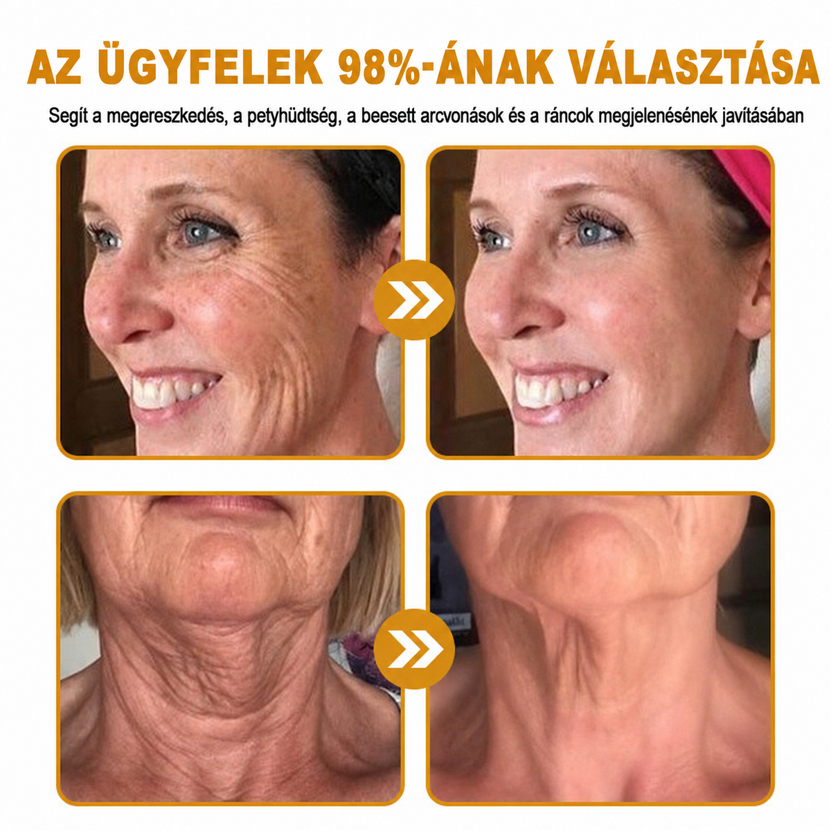 HISKIN® Golden Silk Protein Peptide Beauty Pen — Célzott szépségápolás a ráncok, szemkörnyék és ajkak ápolására | Látható eredmény már 3 nap alatt ✨
