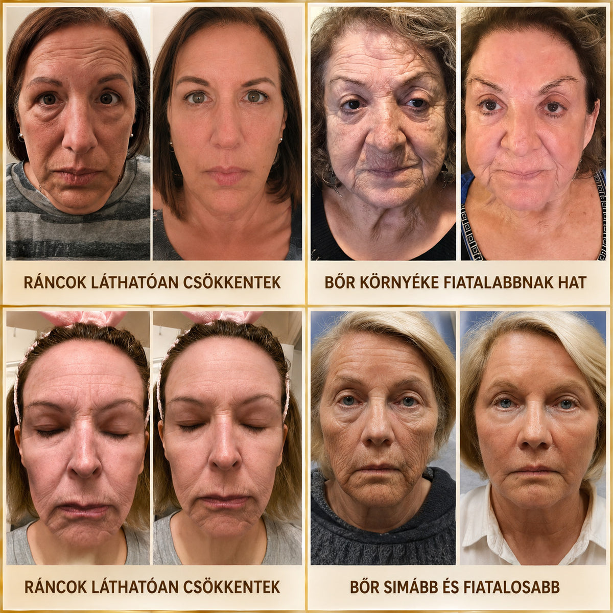 HISKIN® Golden Silk Protein Peptide Beauty Pen — Célzott szépségápolás a ráncok, szemkörnyék és ajkak ápolására | Látható eredmény már 3 nap alatt ✨