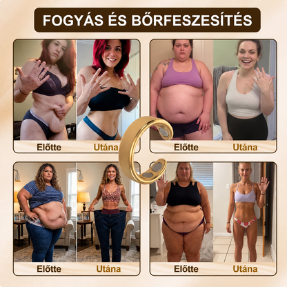 Resupe® Fogyókúrás Anyagcsere Mágneses Terápiás Gyűrű: Hárommagos Anyagcsere Aktiválás — Mindössze 30 perc naponta a Fogyás és a Nyirokkeringés támogatására — Plusz ízületi enyhülés, jobb alvás és mentális tisztaság.